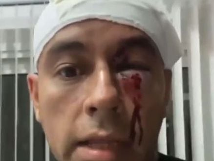 Ensangrentado y con un ojo morado: así quedó el vecino atacado por los cuatro delincuentes dentro de un country