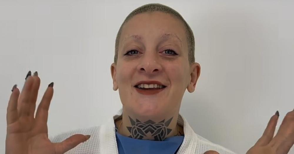 Furia Scaglione se sometió a una cirugía estética y mostró su impactante cambio
